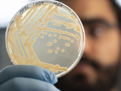 بعض الميكروبات القديمة المجمدة مع أوتزي رجل الثلج لا تزال تنمو
| itg-ar.com بعض الميكروبات القديمة المجمدة مع أوتزي رجل الثلج لا تزال تنمو
| itg-ar.com