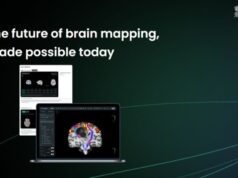 تستخدم الشركة الناشئة في بنغالورو الذكاء الاصطناعي لتحقيق الدقة في رعاية الصحة العقلية والعقلية
| itg-ar.com تستخدم الشركة الناشئة في بنغالورو الذكاء الاصطناعي لتحقيق الدقة في رعاية الصحة العقلية والعقلية
| itg-ar.com