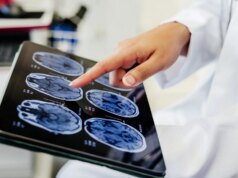 تقوم الرقاقة الذكية الصينية بتعيين هياكل الدماغ بسرعة تصل إلى 478 مرة أسرع من وحدة معالجة الرسومات NVIDIA A100
| itg-ar.com تقوم الرقاقة الذكية الصينية بتعيين هياكل الدماغ بسرعة تصل إلى 478 مرة أسرع من وحدة معالجة الرسومات NVIDIA A100
| itg-ar.com