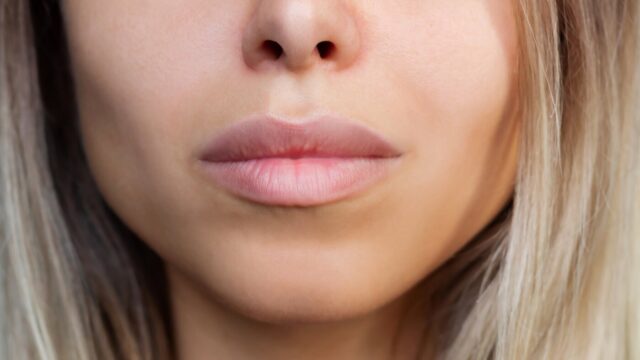 في سعينا وراء "وجه إنستغرام"، هل نفقد العيوب التي تجعلنا بشرًا؟
| itg-ar.com